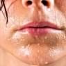Sweating